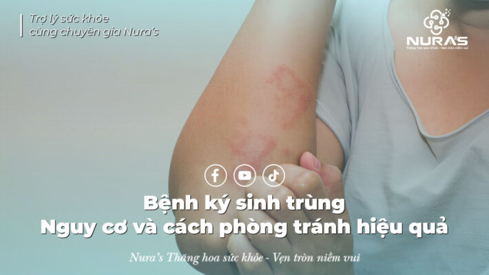 Bệnh ký sinh trùng - Nguy cơ rình rập và cách phòng tránh hiệu quả