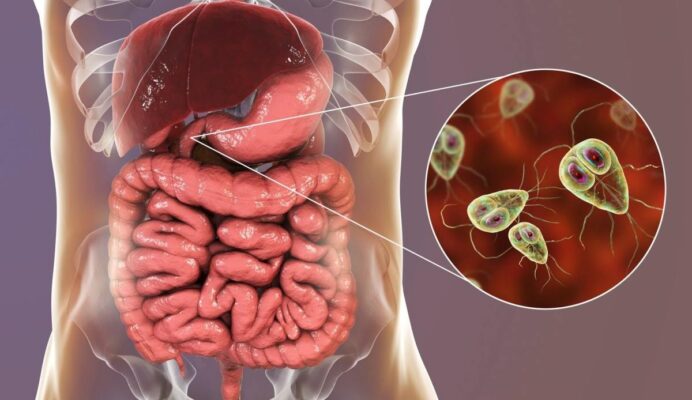 Các hình thức ký sinh của ký sinh trùng